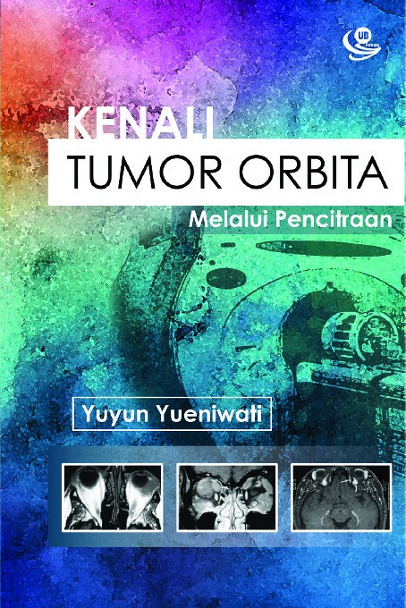 Kenali Tumor Orbita melalui Pencitraan